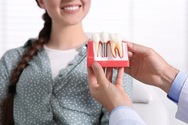 Asking Your Dentist If Dental Implants Are Right For You